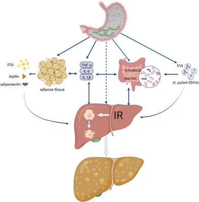 An update: is there a relationship between H. pylori infection and nonalcoholic fatty liver disease? why is this subject of interest?